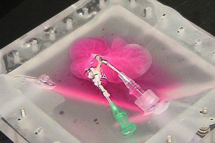 Szervkereskedelem - Élő donorokat verbuvált egy férfi Ukrajnában